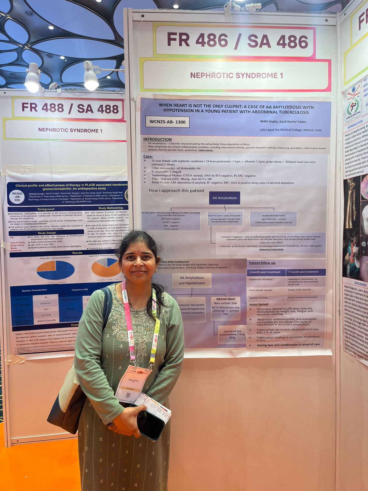 AA Amyloidosis with nephrotic syndrome case poster by Dr. Nidhi Gupta at World Congress of Nephrology 2025